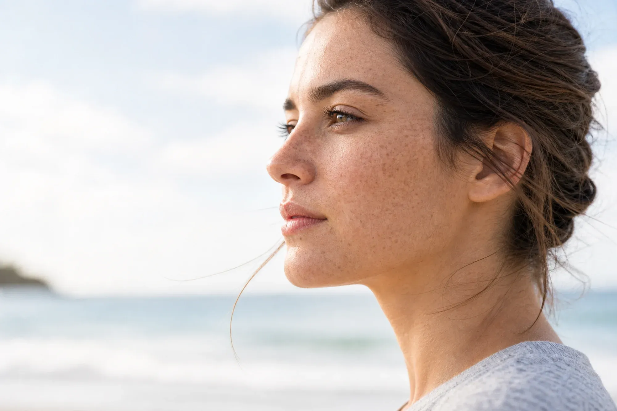 Are Freckles Genetically Inherited?
