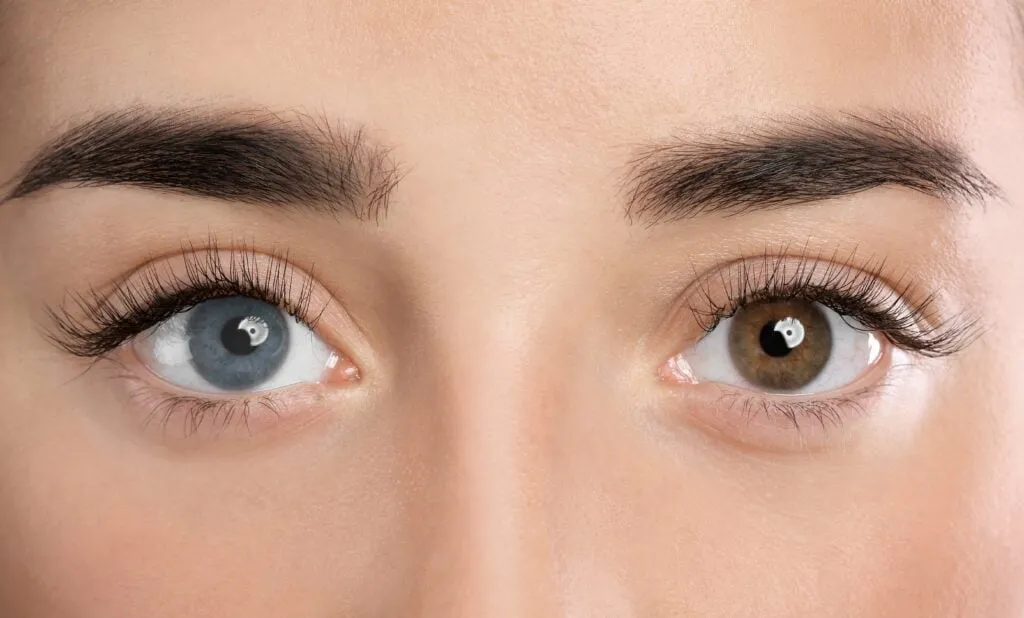 Is Heterochromia Genetic? Types, Symptoms, and Complications 1