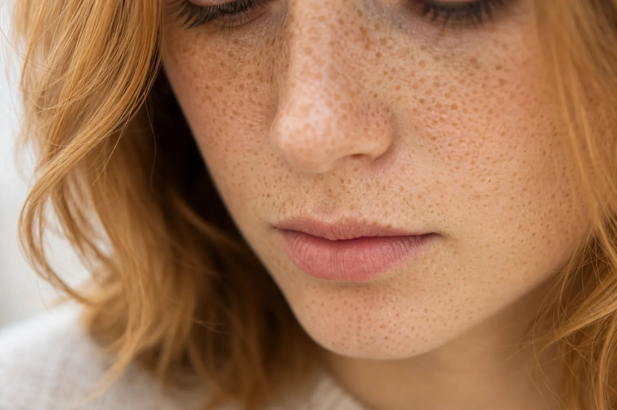 What Percentage of the World Has Freckles?